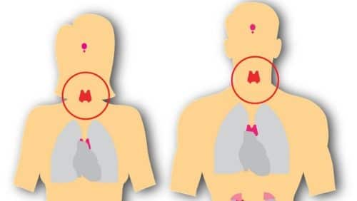Can stress cause Cardiac arrest for escorts?