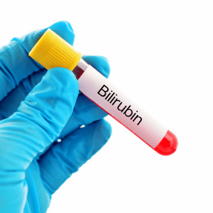 bilirubin test Blood at home image po