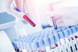 Immuno Levels: What are yours?
