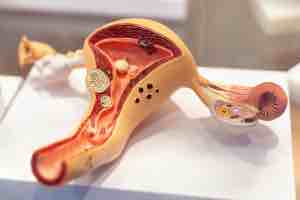 Cause of Diseases of the Cervix?