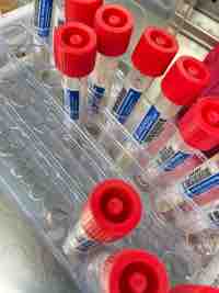 Is Ureaplasma MGen Public Infection alarm unjustified?