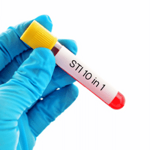 STI test 10 in 1 home kit Chlamydia Herpes HPV Mycoplasma Ureaplasma