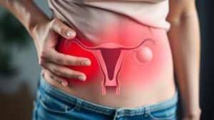 ovarian cancer, ca125 blood test HPV Variant Kit po