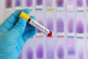 My ex Badly Cheated and gave me a Disease!